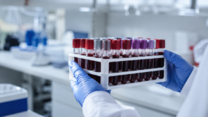 Des mains gantées tiennent un portoir de tubes de prélèvement sanguin dans un laboratoire de recherche.